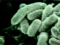 anthrax spores